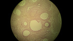 MISSING THUMBNAIL